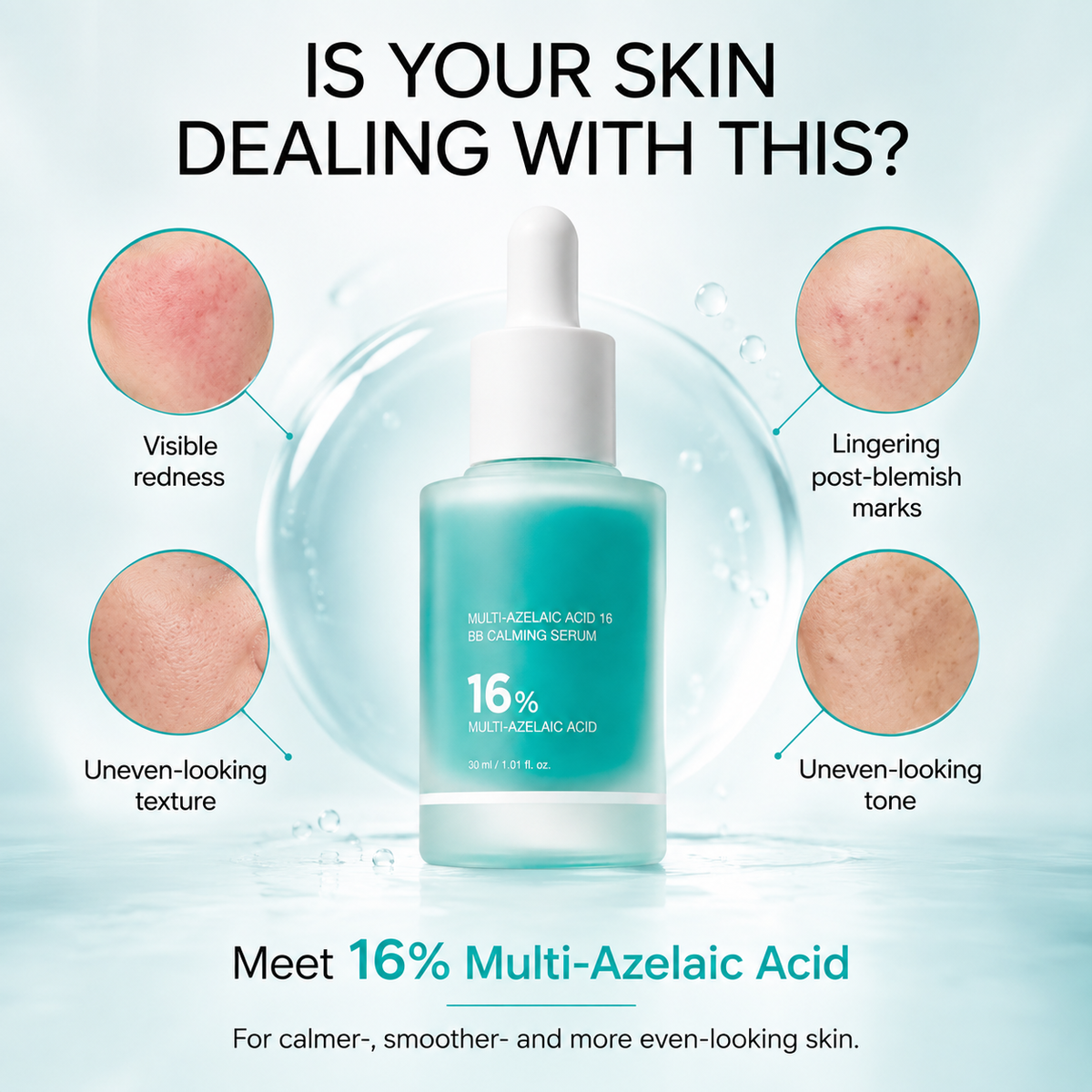 Azelaic Acid 16 Calming Serum