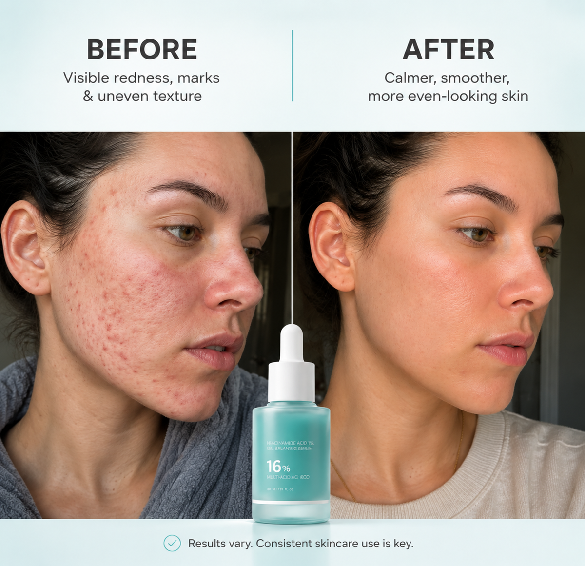 Azelaic Acid 16 Calming Serum